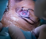 Future Treatments for Corneal Disorders