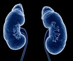 UCLA study identifies key protein driving kidney scarring