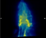 AXT makes magnetic particle imaging technology available to researchers in Australia