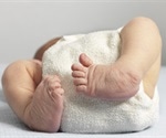 Birth Defects