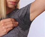 Innovative treatment option for excessive sweating