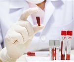 Clinical Chemistry Tests