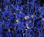 Standardized brain cell atlas to accelerate Parkinson's and Alzheimer's research