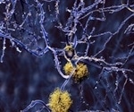 Traditional South Asian medicinal plants show promise in addressing memory disorders