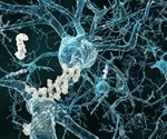 Biological age of the brain emerges as a powerful predictor of longevity