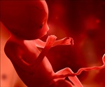 Zika virus can cross the placental barrier, according to new study