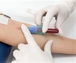 Blood test detects early signs of liver transplant rejection