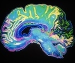 Uncovering origins of autism, depression, Parkinson's in fetal brain