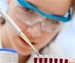 Yale research supports MRD detection for post-treatment lung cancer care
