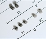 Study is the first to identify involvement of chromosome 21 in developmental regression autism