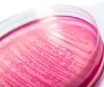 Australian scientists use AI to create protein that kills superbugs