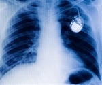 Artificial neural network creates synthetic x-ray images to overcome regulatory limitations