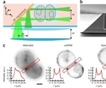Andor’s sCMOS camera leads to new microscopy method