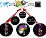 AXT expands preclinical imaging portfolio with addition of inviCRO’s innovative software platforms