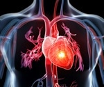 This test can see a heart attack in your future