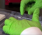 Western Blot - Lab Technique Used to Detect Proteins