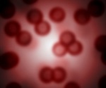 New study reveals mechanism of inflammation in lupus
