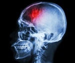 Research may help treat muscular dystrophies and other muscle diseases caused by glycosylation defects