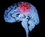 Polyglycine aggregates disrupt tRNA splicing and drive neurodegeneration