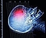 Prime editing reverses symptoms of severe childhood neurological disease