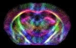 Preclinical to Clinical