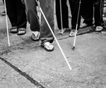 Study may represent a possible surgery-free strategy for managing cataracts