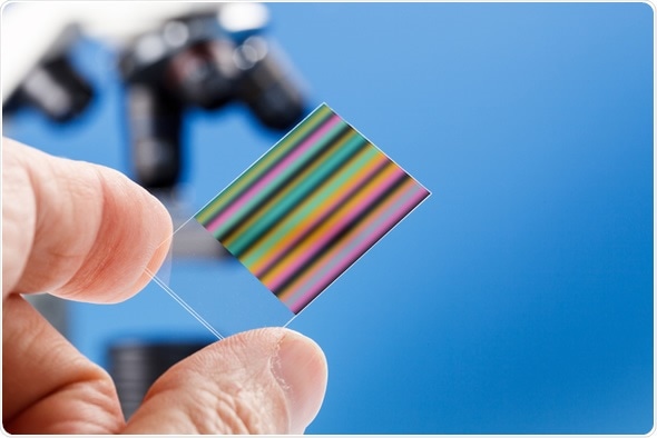 Chromatography genetic fingerprinting - Image Copyright: science photo / Shutterstock Chromatography genetic fingerprinting - Image Copyright: science photo / Shutterstock
