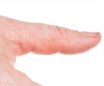 Gastrointestinal Disease and Skin Problems