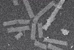 Studying Protein Dynamics in Disease with NMR