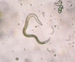 Toxocariasis: Background, Types, Diagnosis, Treatment