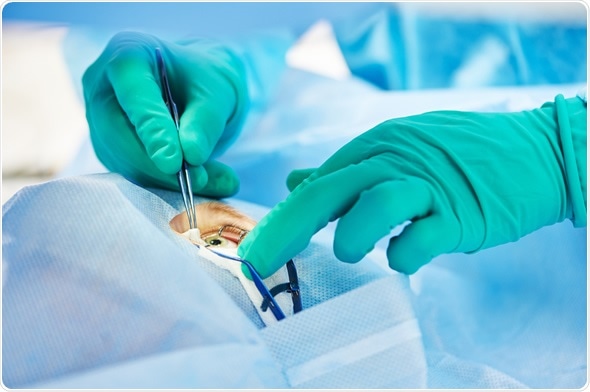Ophthalmology operation - Image Copyright: Dmitry Kalinovsky / Shutterstock