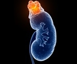 Researchers find link that could aid in treatment of kidney cyst diseases