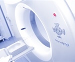 Novel imaging approach accurately identifies sub-types of primary aldosteronism