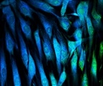 New procedure standard/practice guideline released for fibroblast activation protein PET