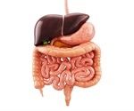 Study: Early advanced therapy significantly improves Crohn's disease outcomes