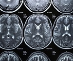 Micro-MRI Principles, Strengths, and Weaknesses