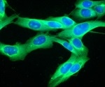 New insights into melanoma metastasis reveal potential drug target