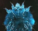 Scabies in Babies