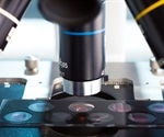 Stimulated Emission Depletion (STED) Microscopy in Research