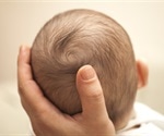 What are Fontanelles?