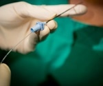 Labor epidurals linked to lower risk of severe maternal morbidity