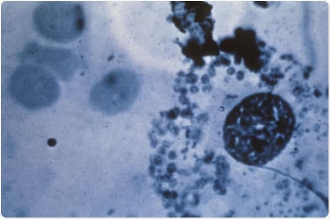 This photomicrograph reveals “Donovan bodies” in a skin sample used to diagnose granuloma inguinale.
