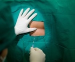 Epidural steroid injections may offer modest short-term pain relief for some back pain