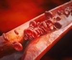 KLX mitigates atherosclerotic progression by preventing EndMT