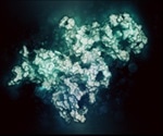 New x-ray analysis methodology reveals structure of disordered protein