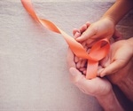 Immunotherapy shows promise in changing leukemia’s cellular environment