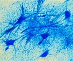 Study demonstrates for the first-time neurons moving in postnatal neurogenesis