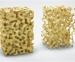 Air pollution may exacerbate osteoporosis