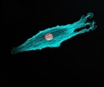 Study finds specific tumor environment that stimulates cancer cells to metastasize