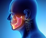 Cysts of the Jaws